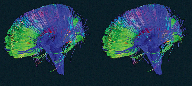Your Brain Has A “Delete” Button—Here’s How To Use It Your Brain Has A “Delete” Button—Here’s How To Use It